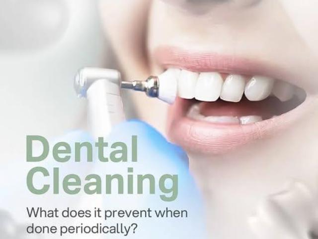 Teeth Whitening in Claremont