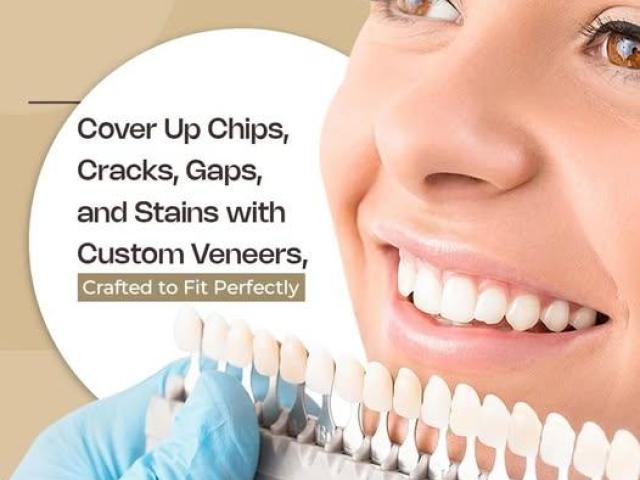Implant Crowns Claremont