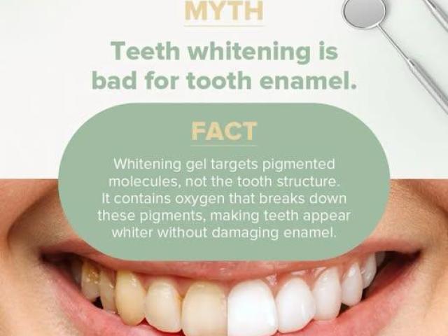 Dental Bridges in Claremont