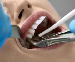 orthognathic surgery los angeles