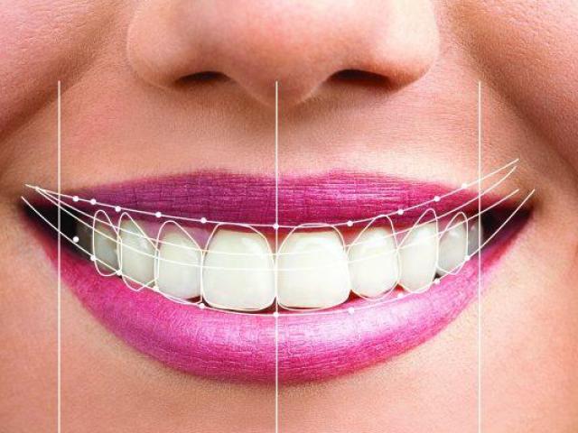 Cosmetic Dentistry Services in Palo Alto