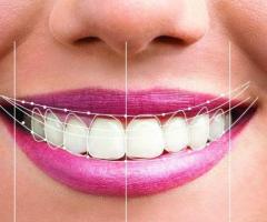 Cosmetic Dentistry Services in Palo Alto