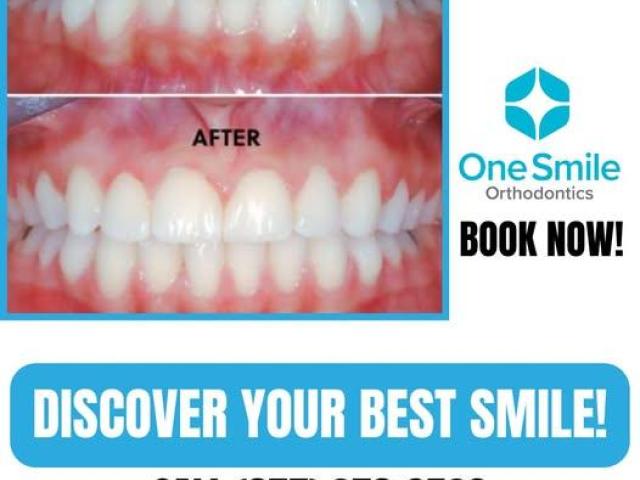 Advanced Dental treatments West Covina