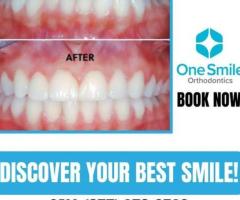 Advanced Dental treatments West Covina