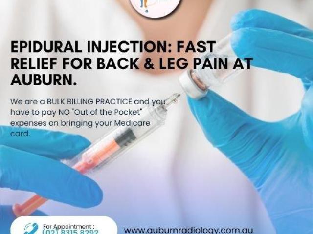 Epidural Injection: Fast Relief for Back & Leg Pain at Auburn Radiology. (02) 8315 8292
