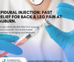 Epidural Injection: Fast Relief for Back & Leg Pain at Auburn Radiology. (02) 8315 8292