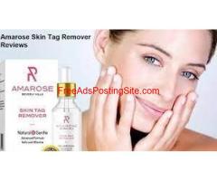 Amarose Skin Tag Remover – Is It Right For You?