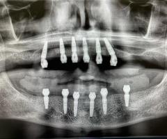 Holistic Dentist in Mexico – Natural, Biocompatible Care for Your Health and Smile