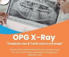OPG X-Ray: Complete Jaw & Teeth Scan in One Image at Auburn Radiology. (02) 8315 8292
