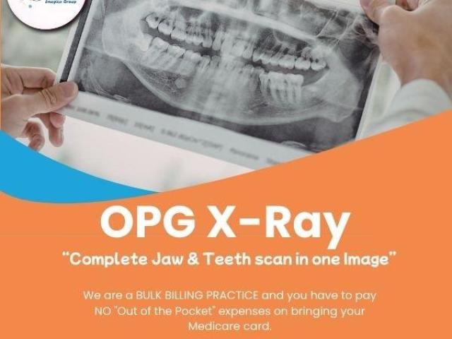 OPG X-Ray: Complete Jaw & Teeth Scan in One Image at Butler Medical Imaging. (08) 9544 3999