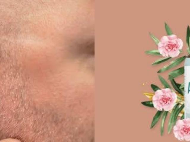 Audileaf Australia Reviews: The Natural Way to Support Better Hearing Health!