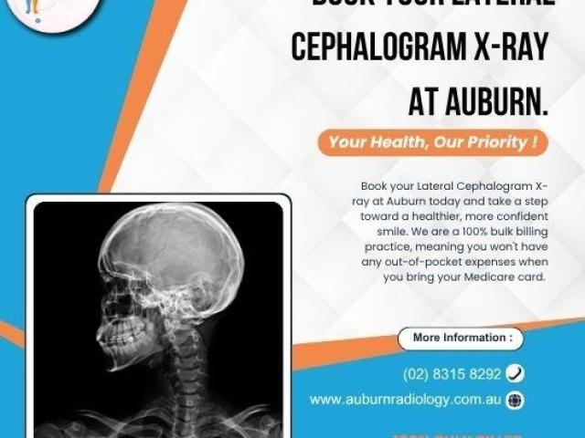Book a Lateral Cephalogram at Auburn Radiology. (02) 8315 8292