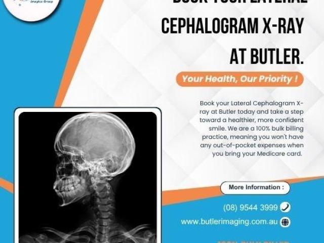 Book a Lateral Cephalogram at Butler Medical Imaging. (08) 9544 3999