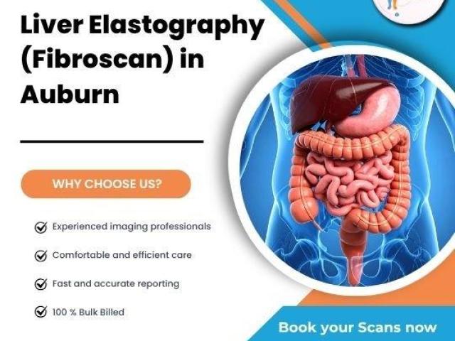 Liver Elastography (Fibroscan) at Auburn Radiology. (02) 8315 8292