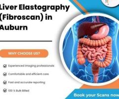 Liver Elastography (Fibroscan) at Auburn Radiology. (02) 8315 8292