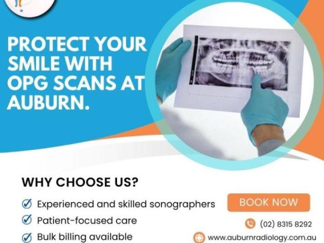 Protect Your Smile with OPG Scans at Auburn Radiology. (02) 8315 8292