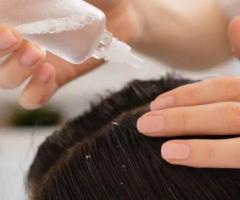 Best Hair Clinic For Anti-Dandruff Treatment In Coimbatore