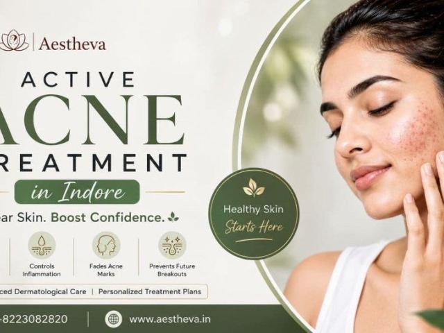 Active Acne Treatment in Indore – Aestheva