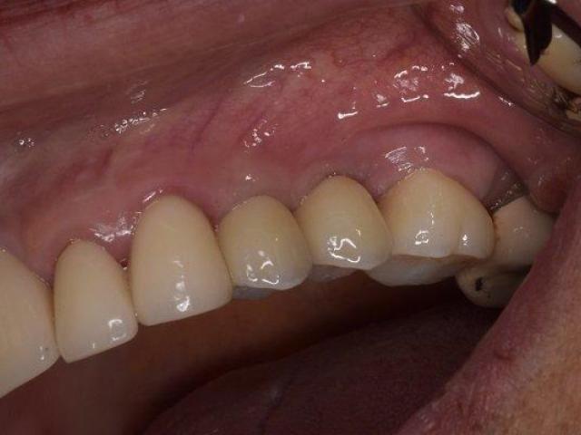 Get Your Perfect Smile by Treating from Dentist in Tijuana