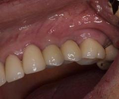 Get Your Perfect Smile by Treating from Dentist in Tijuana