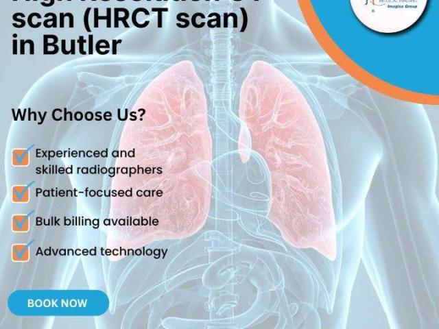 High Resolution CT Scan (HRCT) at Butler Medical Imaging. (08) 9544 3999