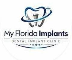 Dental Implants Port St Lucie