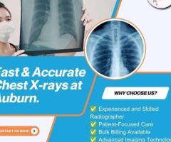 Fast & Accurate Chest X-Rays at Auburn Radiology. (02) 8315 8292