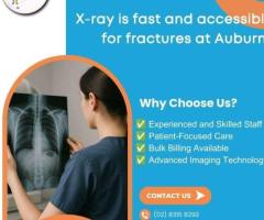 X-ray is fast and accessible for fractures at Auburn Radiology. (02) 8315 8292