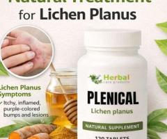 How to Get Rid of Lichen Planus Naturally